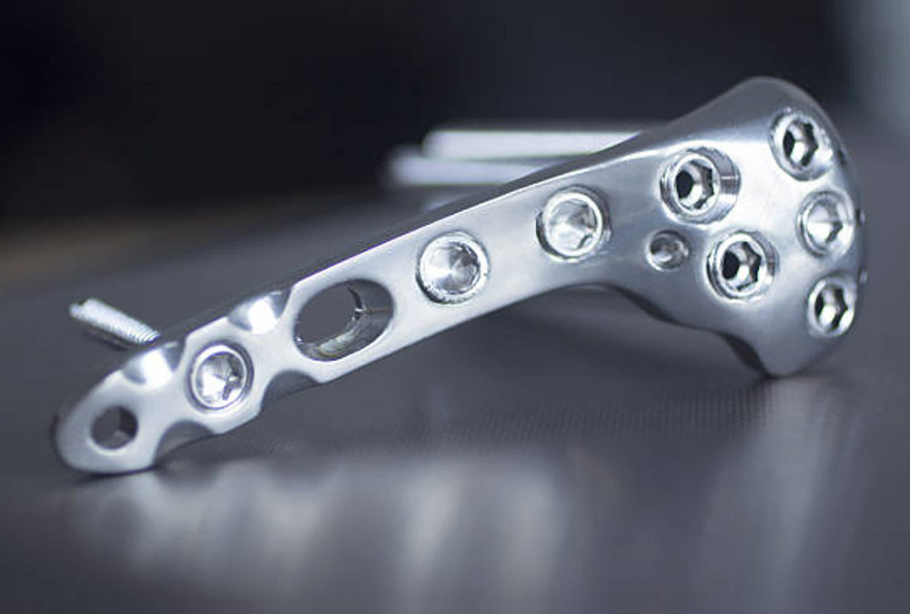Ultrasonic Cleaning of Medical Implants